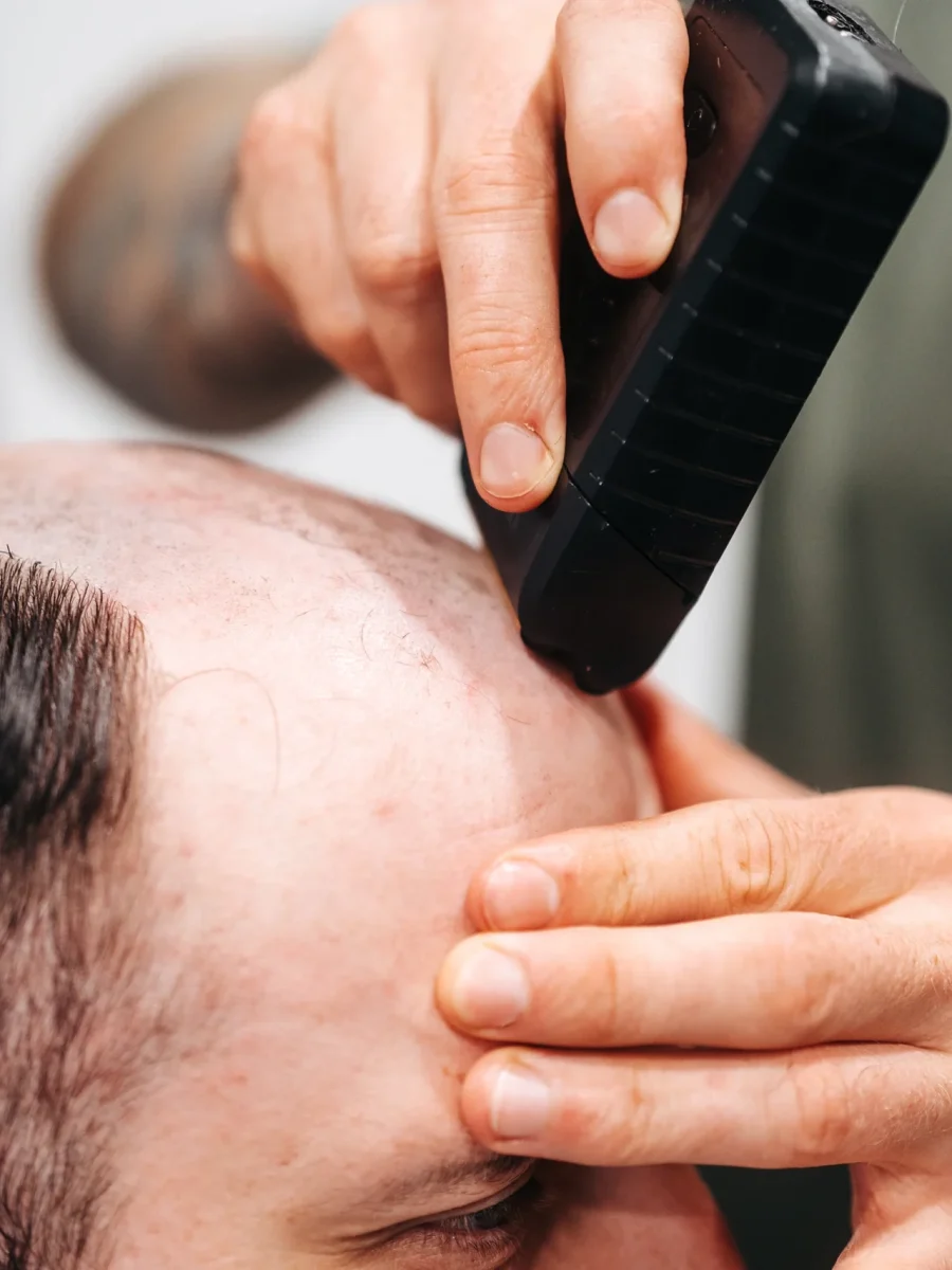 close up of man having new hair system in Cardiff with barber